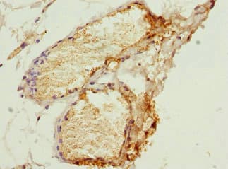 SERPIND1 / Heparin Cofactor 2 Antibody