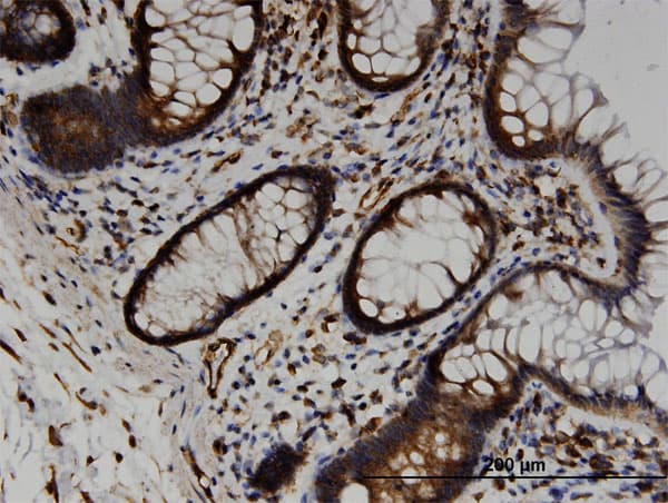 TRAM2 Antibody (clone 3G6)