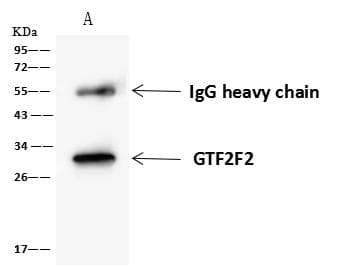 RAP30 / GTF2F2 Antibody