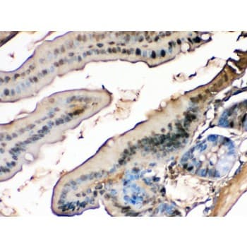 FABP1 / L-FABP Antibody (aa6-36)