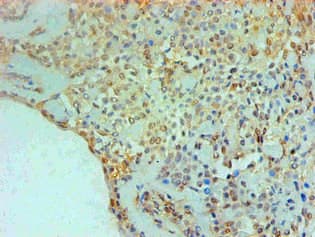 TGM2 / Transglutaminase 2 Antibody (clone 3H2B8)