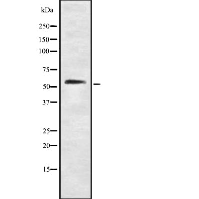 GSPT1 Antibody