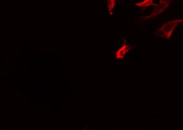 Polyclonal Rabbit anti-Human DEC-205 / CD205 / LY75 Antibody (IF, WB)