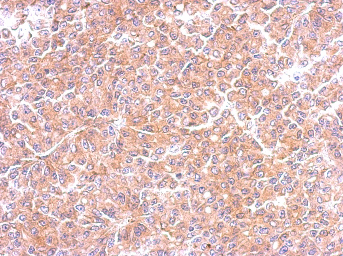 EML1 / EMAP Antibody (aa753-815)