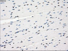 FCGR2 / CD32 Antibody (clone OTI13G9)