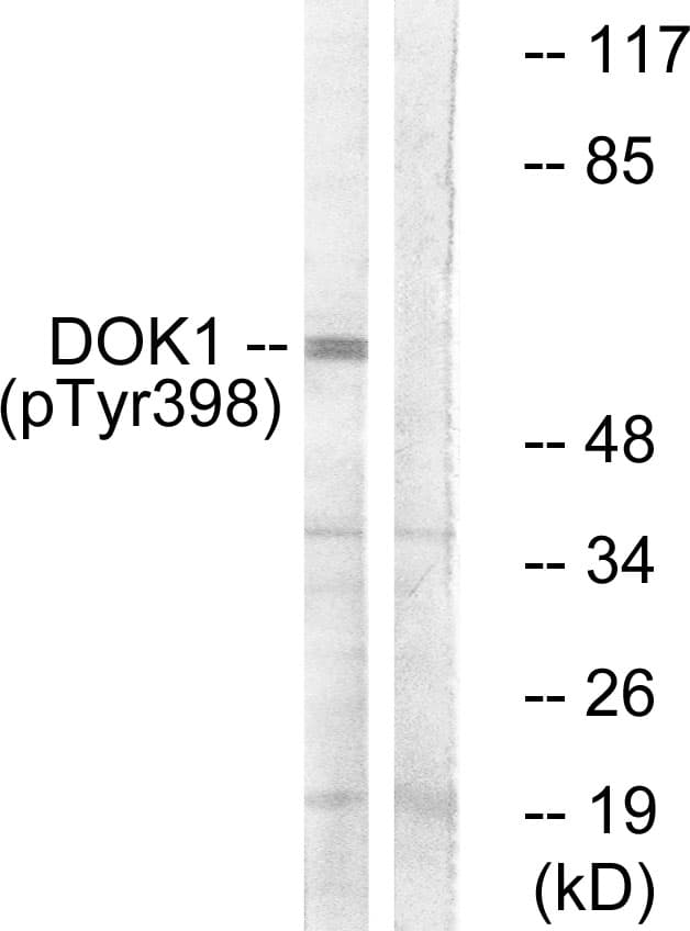 DOK1 Antibody (phospho-Tyr398)