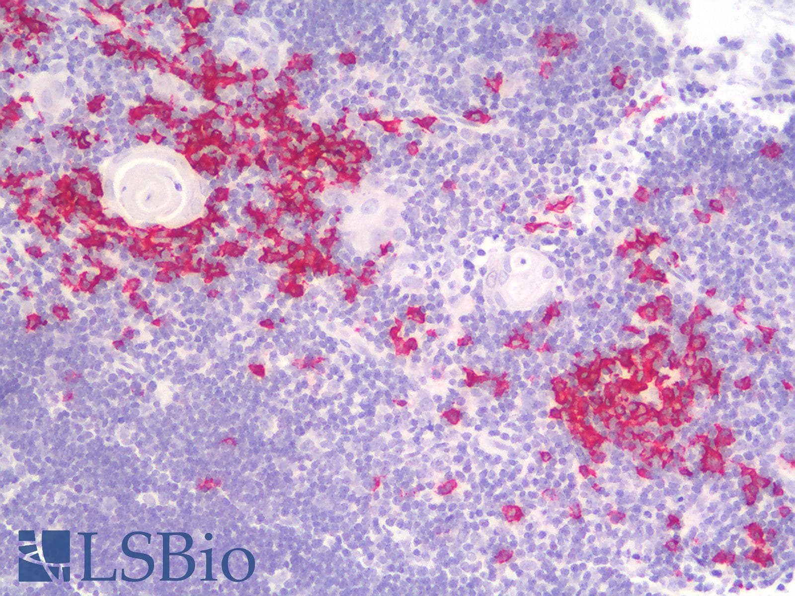 PathPlus™ CD20 Antibody (clone rIGEL/773)
