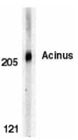 PathPlus™ ACIN1 / Acinus Antibody