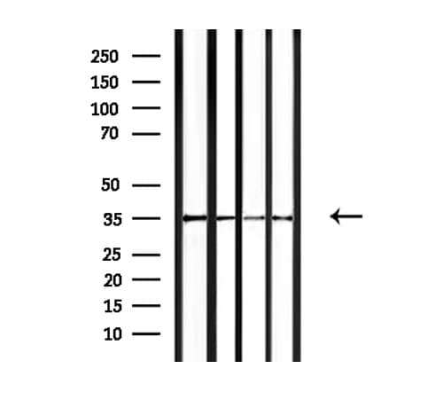 OR4F15 Antibody