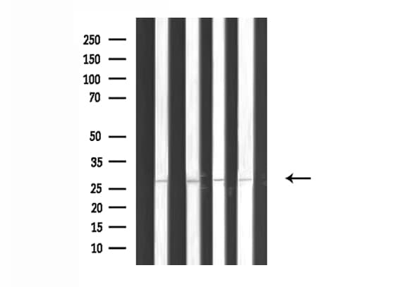 Polyclonal Rabbit anti-Human MYF5 / MYF 5 Antibody (IF, WB)