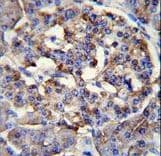 PPP1R37 Antibody (aa36-64)