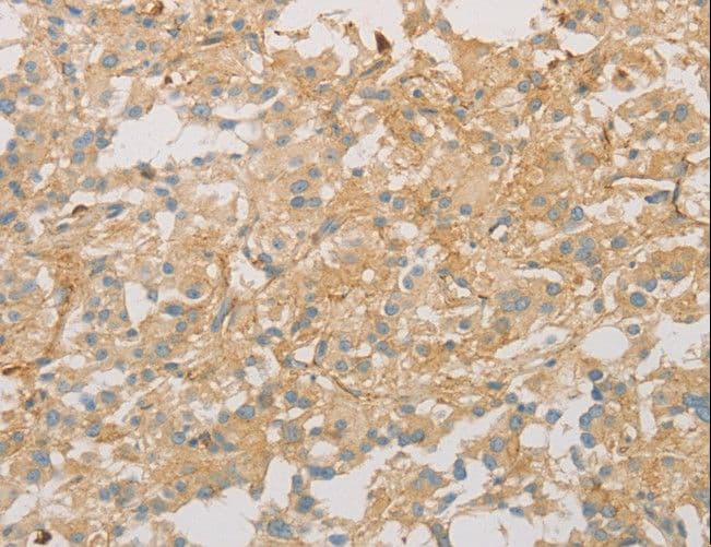 Polyclonal Rabbit anti-Human VTN / Vitronectin Antibody (IHC)