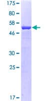 Human TPM3 Protein (Recombinant GST)