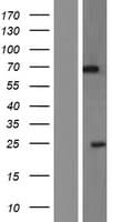 PIP5K1A Protein (Over-Expression Lysate Myc-DDK (Flag))