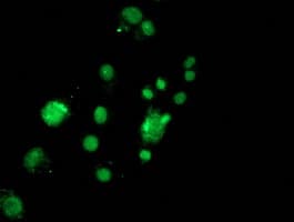 PDIA4 / ERP72 Antibody (clone OTI2B11)