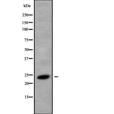 Polyclonal Rabbit anti-Human RAB8B Antibody (WB)