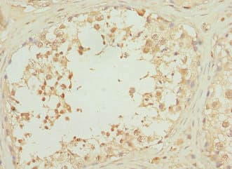 Polyclonal Rabbit anti-Human RPS6KL1 Antibody (IHC, WB)