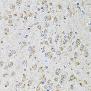 IHC-plus™ MTTP / MTP Antibody