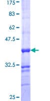 Human ALPPL2 Protein (Recombinant GST, N-terminus)