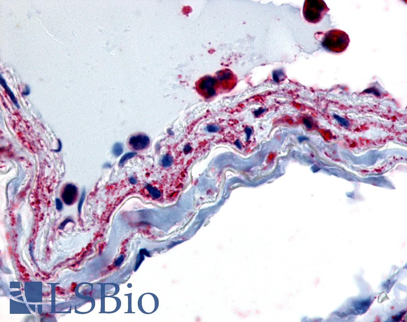 IHC-plus™ PTPMT1 Antibody (Internal)