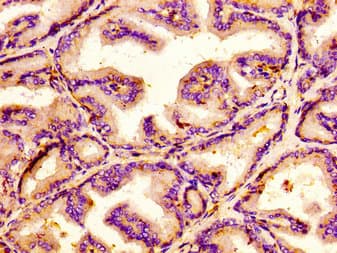 JMY Antibody