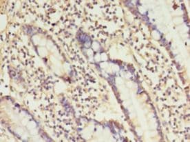 IHC-plus™ ANGPTL2 / ARP2 Antibody (aa23-493)