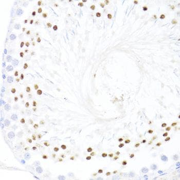 DDX59 Antibody