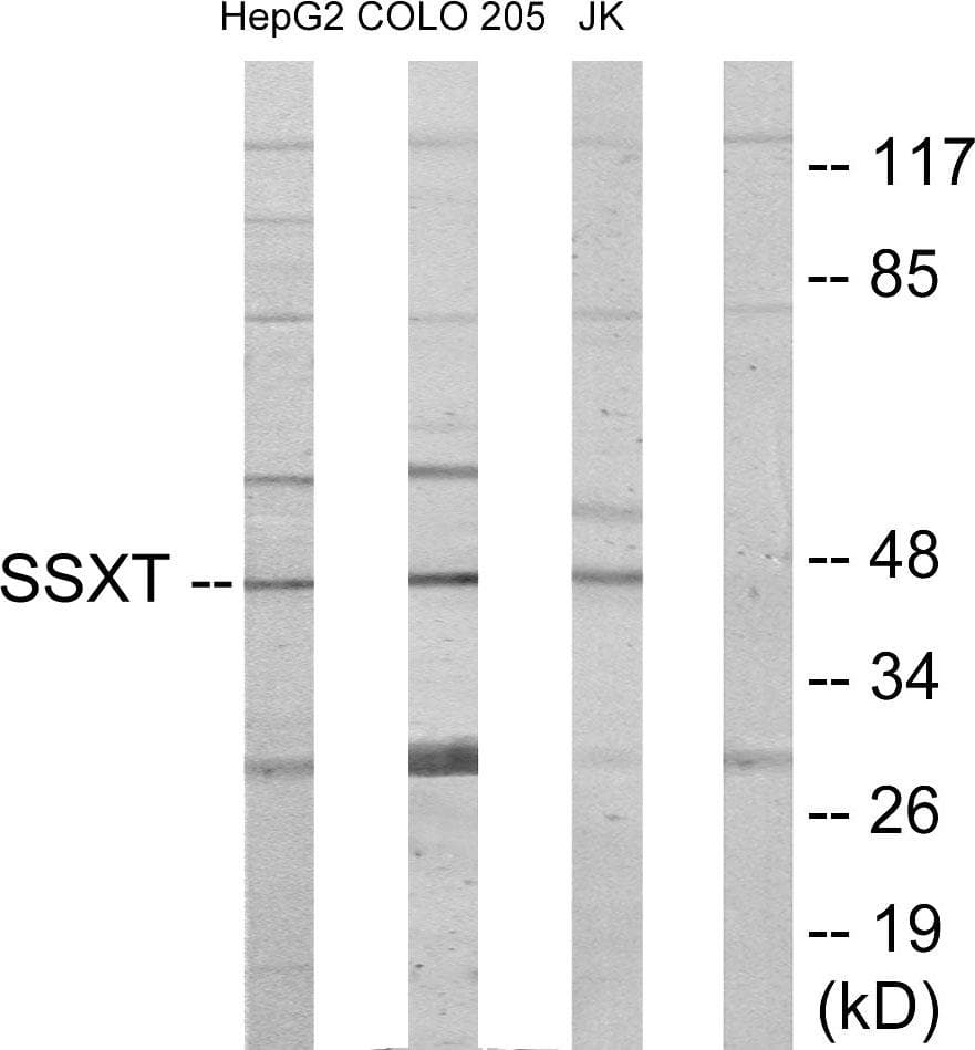 Polyclonal Rabbit anti-Human SS18 Antibody (WB)