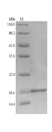 Human UL128 Protein (Recombinant)