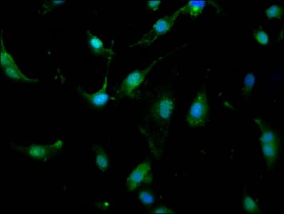 UBR1 Antibody