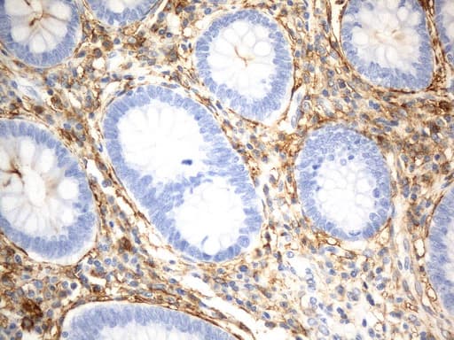 ANPEP / CD13 Antibody (aa668-967, clone UMAB275)