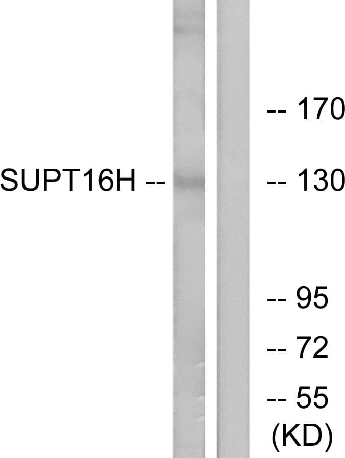 Polyclonal Rabbit anti-Human SUPT16H / FACTP140 Antibody (aa941-990, WB)