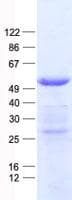 Human SKP2 Protein (Recombinant His, N-Terminal)