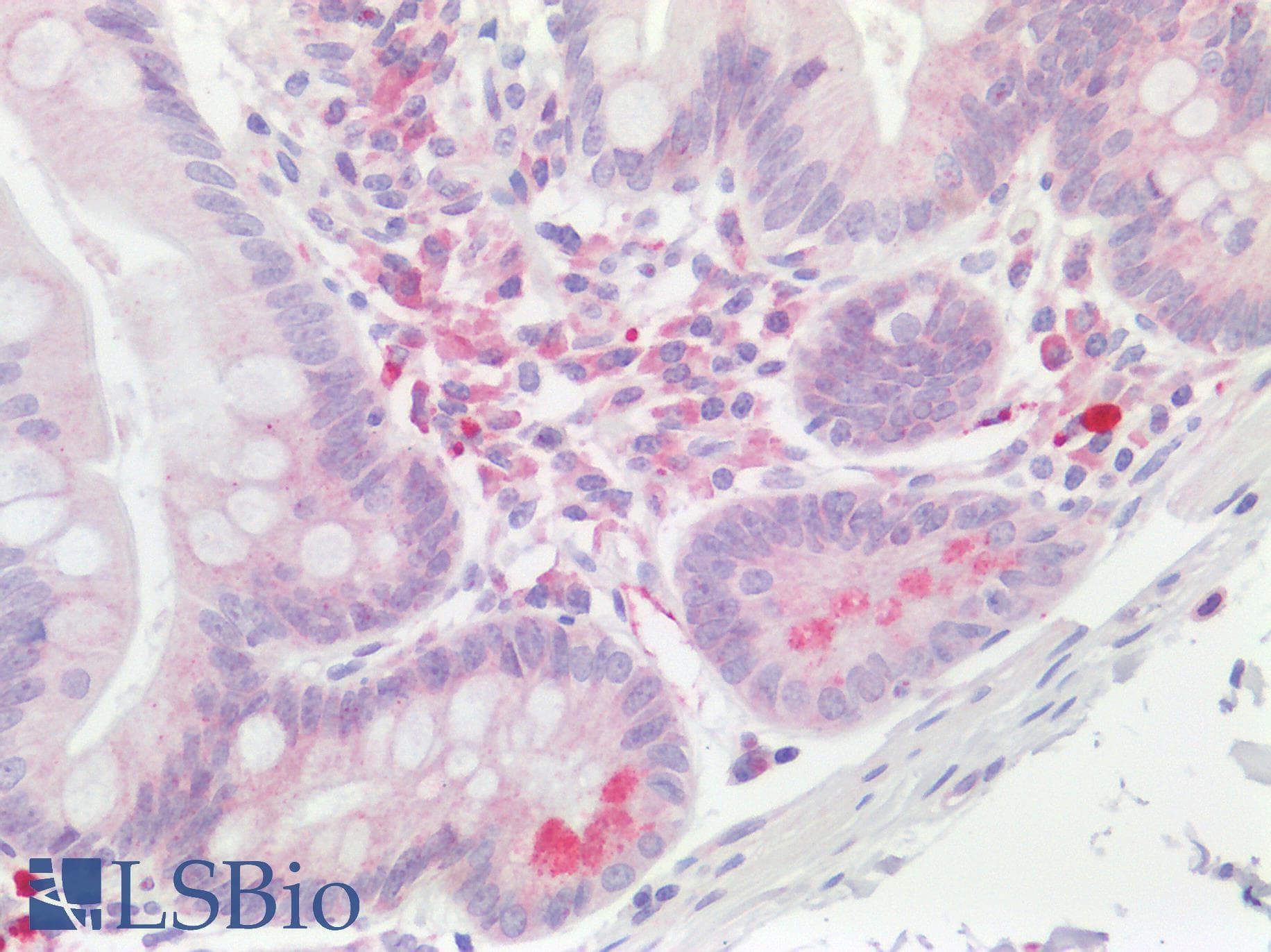 HAPLN1 Antibody (aa35-84)