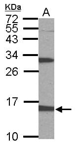 Polyclonal Rabbit anti-Human PTS Antibody (aa1-145, IHC, WB)