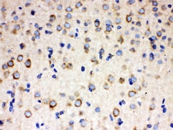 ULK3 Antibody