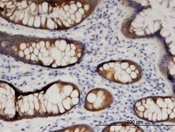ARFIP1 Antibody (clone 1F10)