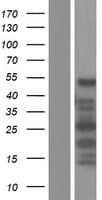 CDR2L Protein (Over-Expression Lysate Myc-DDK (Flag))