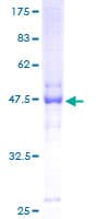 Human NOL6 / NRAP Protein (Recombinant GST)