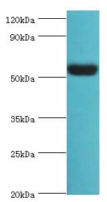 VTN / Vitronectin Antibody (aa364-478)