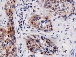 AK5 / Adenylate Kinase 5 Antibody (clone OTI2F9)