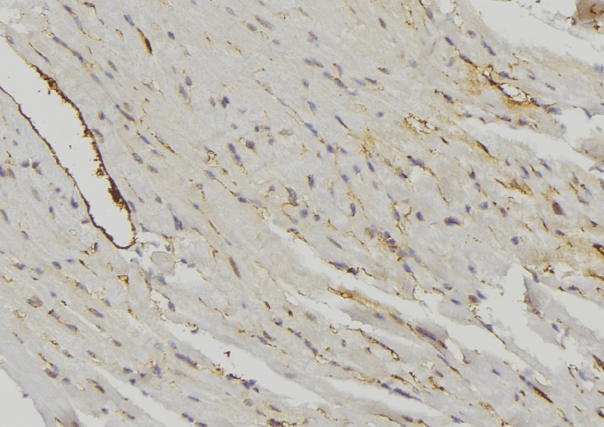 Polyclonal Rabbit anti-Human MRPS16 Antibody (aa41-66, IHC, IF, WB)