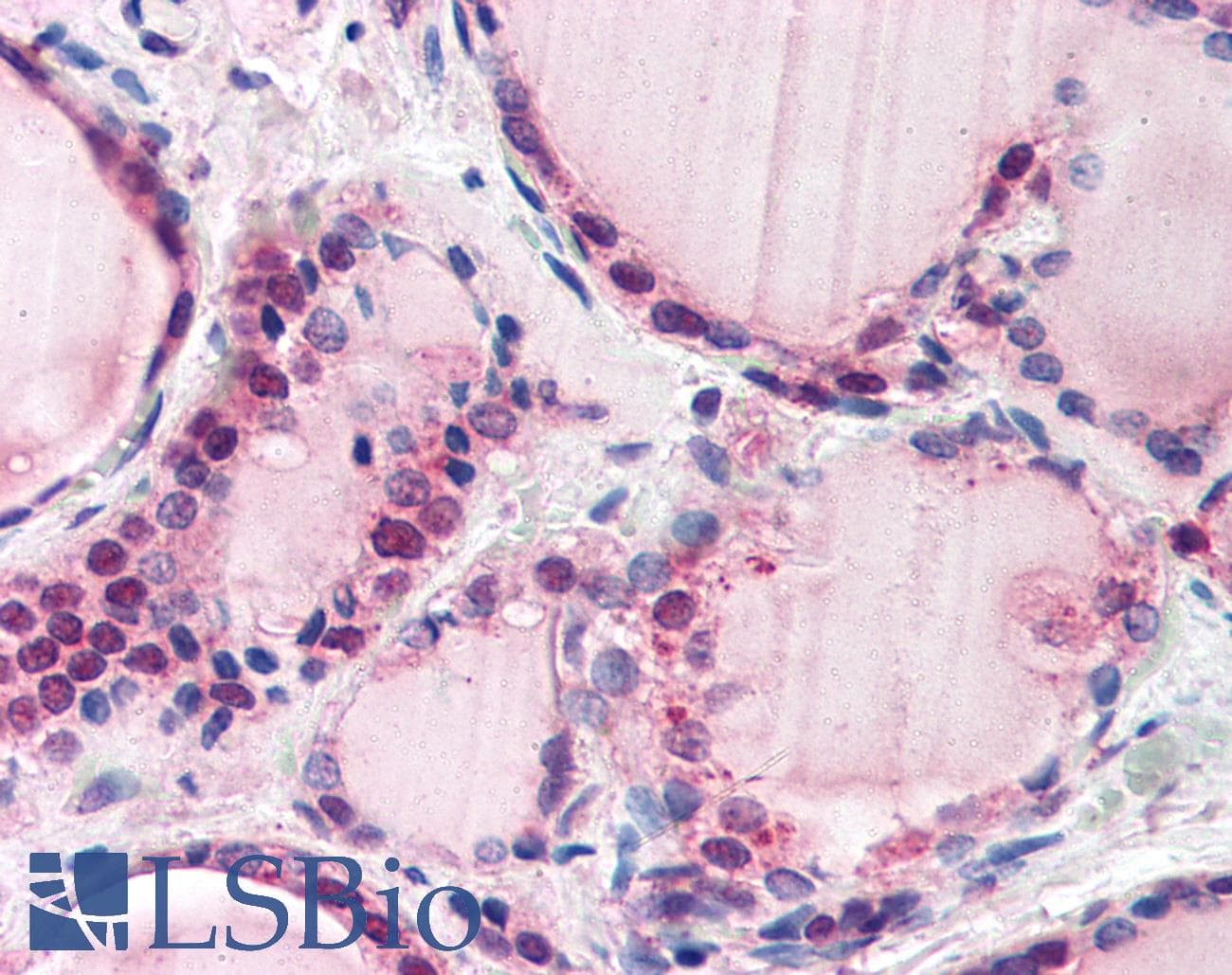 IHC-plus™ FBXL3 Antibody (aa2-15)