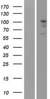 EPHA2 / EPH Receptor A2 Protein (Over-Expression Lysate Myc-DDK (Flag))