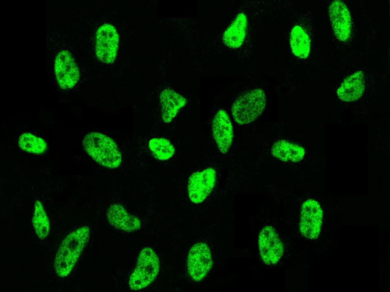 PSME3 Antibody (Preservative Free)