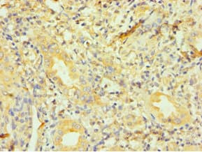 Polyclonal Rabbit anti-Human DCTN1 / Dynactin 1 Antibody (aa1084-1278, IHC, WB)