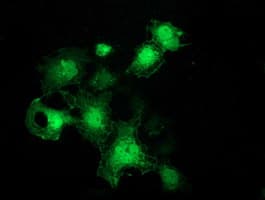 SLIM / FHL1 Antibody (clone OTI2E11)