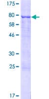 Human TBC1D10C / CARABIN Protein (Recombinant GST)