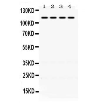Mineralocorticoid Receptor Antibody (aa950-984)