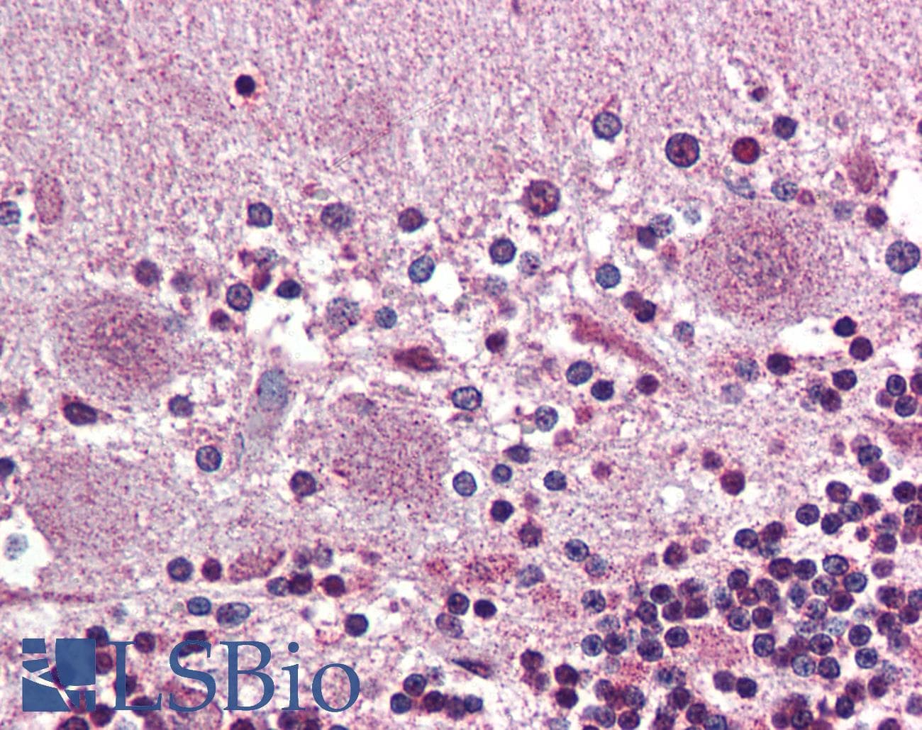 IHC-plus™ PROKR2/Prokineticin Receptor 2 Antibody (N-Terminus)